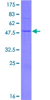 WARS2 Protein - 12.5% SDS-PAGE of human WARS2 stained with Coomassie Blue