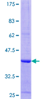 WARS2 Protein - 12.5% SDS-PAGE Stained with Coomassie Blue.