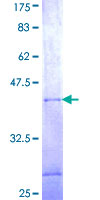 WARS2 Protein - 12.5% SDS-PAGE Stained with Coomassie Blue.