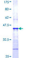 WAS / WASP Protein - 12.5% SDS-PAGE Stained with Coomassie Blue.