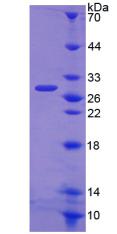 WAS / WASP Protein - Recombinant Wiskott Aldrich Syndrome Protein By SDS-PAGE