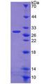 WAS / WASP Protein - Recombinant Wiskott Aldrich Syndrome Protein By SDS-PAGE