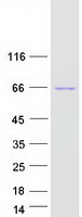WAS / WASP Protein - Purified recombinant protein WAS was analyzed by SDS-PAGE gel and Coomassie Blue Staining