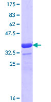 WASF1 / WAVE Protein - 12.5% SDS-PAGE Stained with Coomassie Blue.