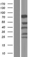 WASF2 / SCAR2 Protein - Western validation with an anti-DDK antibody * L: Control HEK293 lysate R: Over-expression lysate