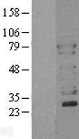 WASL / N-WASP Protein - Western validation with an anti-DDK antibody * L: Control HEK293 lysate R: Over-expression lysate