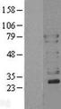 WASL / N-WASP Protein - Western validation with an anti-DDK antibody * L: Control HEK293 lysate R: Over-expression lysate