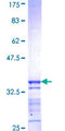 WASL / N-WASP Protein - 12.5% SDS-PAGE Stained with Coomassie Blue.