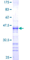 WBP1 Protein - 12.5% SDS-PAGE Stained with Coomassie Blue.