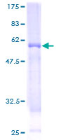 WBP2NL Protein - 12.5% SDS-PAGE of human MGC26816 stained with Coomassie Blue