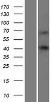 WBP4 Protein - Western validation with an anti-DDK antibody * L: Control HEK293 lysate R: Over-expression lysate