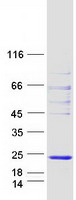 WBP5 Protein - Purified recombinant protein TCEAL9 was analyzed by SDS-PAGE gel and Coomassie Blue Staining