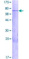 WBSCR16 Protein - 12.5% SDS-PAGE of human WBSCR16 stained with Coomassie Blue