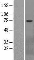 WBSCR17 Protein - Western validation with an anti-DDK antibody * L: Control HEK293 lysate R: Over-expression lysate