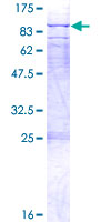 WBSCR17 Protein - 12.5% SDS-PAGE of human WBSCR17 stained with Coomassie Blue