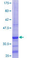 WBSCR22 Protein - 12.5% SDS-PAGE Stained with Coomassie Blue.