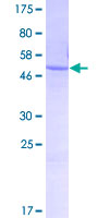 WBSCR27 Protein - 12.5% SDS-PAGE of human WBSCR27 stained with Coomassie Blue