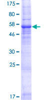 WBSCR28 Protein - 12.5% SDS-PAGE of human WBSCR28 stained with Coomassie Blue