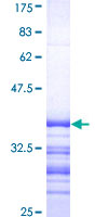 WC1 / ATP7B Protein - 12.5% SDS-PAGE Stained with Coomassie Blue.