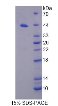 WC1 / ATP7B Protein - Recombinant  ATPase, Cu++ Transporting Beta Polypeptide By SDS-PAGE