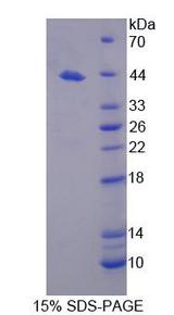 WC1 / ATP7B Protein - Recombinant  ATPase, Cu++ Transporting Beta Polypeptide By SDS-PAGE