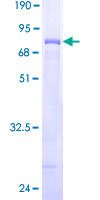 WDFY1 Protein - 12.5% SDS-PAGE of human WDFY1 stained with Coomassie Blue