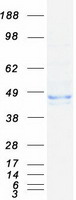 WDFY1 Protein - Purified recombinant protein WDFY1 was analyzed by SDS-PAGE gel and Coomassie Blue Staining