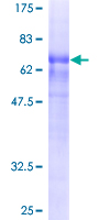 WDFY3 / ALFY Protein - 12.5% SDS-PAGE of human WDFY3 stained with Coomassie Blue