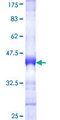 WDHD1 Protein - 12.5% SDS-PAGE Stained with Coomassie Blue.