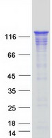WDHD1 Protein - Purified recombinant protein WDHD1 was analyzed by SDS-PAGE gel and Coomassie Blue Staining