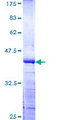 WDR11 / PHIP Protein - 12.5% SDS-PAGE Stained with Coomassie Blue.