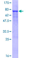 WDR18 Protein - 12.5% SDS-PAGE of human WDR18 stained with Coomassie Blue