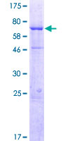 WDR19 Protein - 12.5% SDS-PAGE of human WDR19 stained with Coomassie Blue