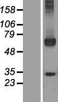 WDR20 Protein - Western validation with an anti-DDK antibody * L: Control HEK293 lysate R: Over-expression lysate