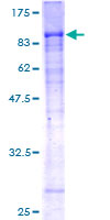 WDR20 Protein - 12.5% SDS-PAGE of human WDR20 stained with Coomassie Blue