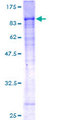 WDR20 Protein - 12.5% SDS-PAGE of human WDR20 stained with Coomassie Blue