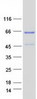 WDR20 Protein - Purified recombinant protein WDR20 was analyzed by SDS-PAGE gel and Coomassie Blue Staining