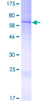 WDR21A / DCAF4 Protein - 12.5% SDS-PAGE of human WDR21A stained with Coomassie Blue