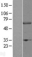 WDR23 / DCAF11 Protein - Western validation with an anti-DDK antibody * L: Control HEK293 lysate R: Over-expression lysate
