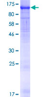 WDR24 Protein - 12.5% SDS-PAGE of human WDR24 stained with Coomassie Blue