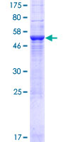 WDR27 Protein - 12.5% SDS-PAGE of human WDR27 stained with Coomassie Blue