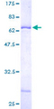 WDR31 Protein - 12.5% SDS-PAGE of human WDR31 stained with Coomassie Blue