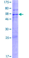 WDR33 Protein - 12.5% SDS-PAGE of human WDR33 stained with Coomassie Blue