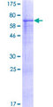 WDR34 Protein - 12.5% SDS-PAGE of human WDR34 stained with Coomassie Blue