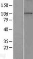 WDR36 Protein - Western validation with an anti-DDK antibody * L: Control HEK293 lysate R: Over-expression lysate