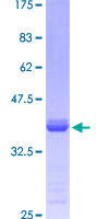 WDR36 Protein - 12.5% SDS-PAGE Stained with Coomassie Blue.