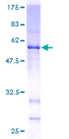 WDR37 Protein - 12.5% SDS-PAGE of human WDR37 stained with Coomassie Blue