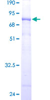 WDR41 Protein - 12.5% SDS-PAGE of human WDR41 stained with Coomassie Blue