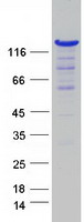 WDR44 Protein - Purified recombinant protein WDR44 was analyzed by SDS-PAGE gel and Coomassie Blue Staining