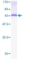 WDR45 Protein - 12.5% SDS-PAGE of human WDR45 stained with Coomassie Blue